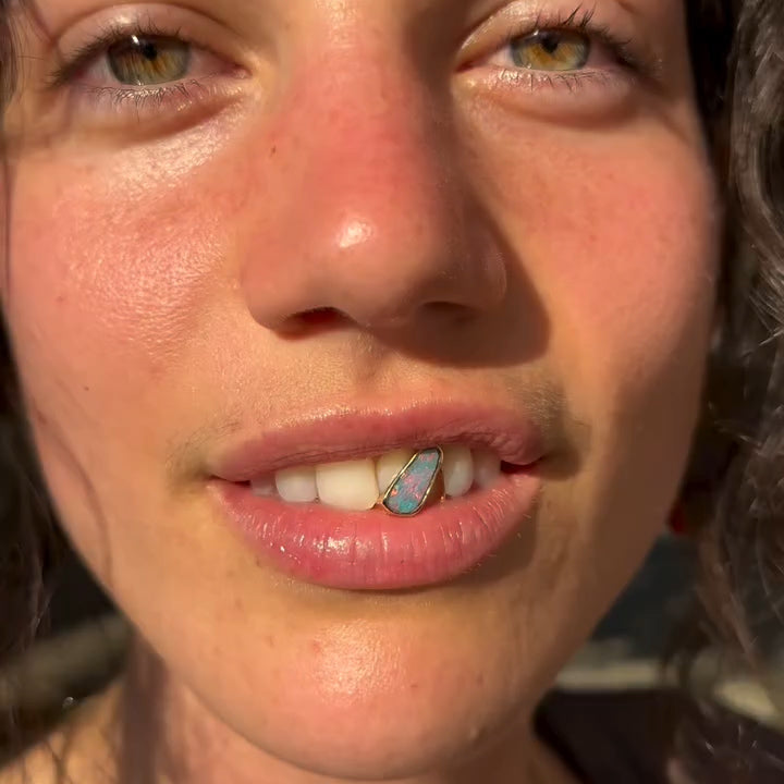 Gold and Australian Opal Tooth Cap