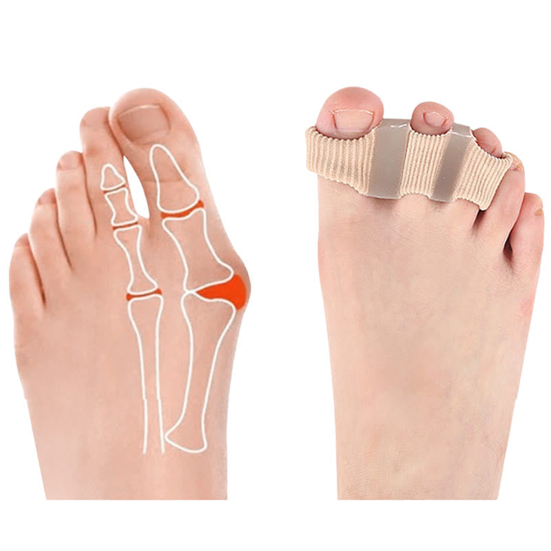 Plusock Multi Hole Toe Alignment Support(2 Packs)